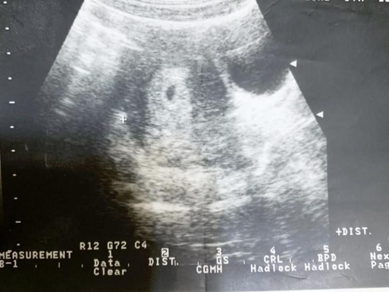 #那一年生命教我學會的事（上）