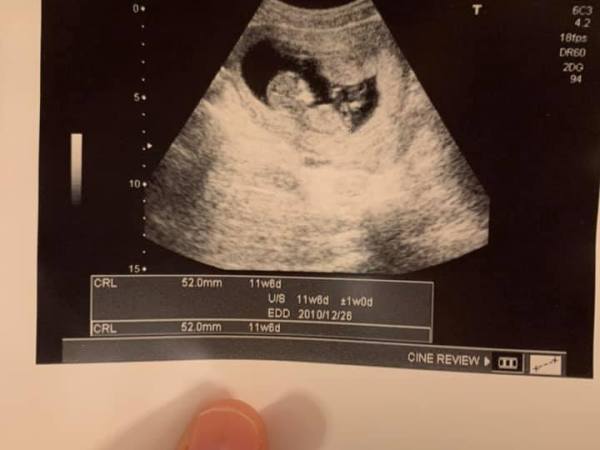 那一年生命教我學會的事（下）